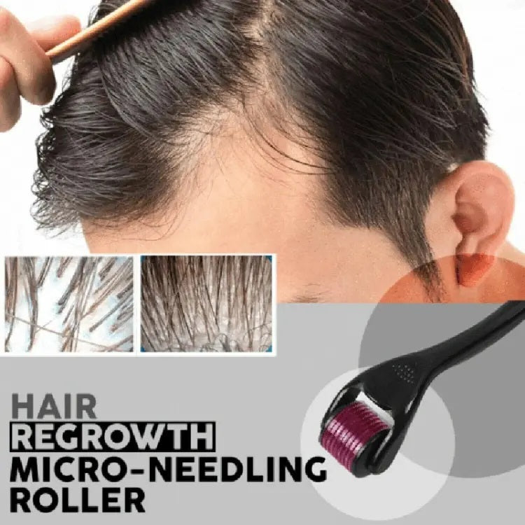 Derma Roller – Reduce Fine Lines for Smooth Skin