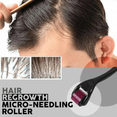 Derma Roller – Reduce Fine Lines for Smooth Skin